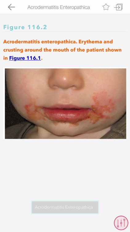 Pediatric Dermatology from AAP screenshot-4