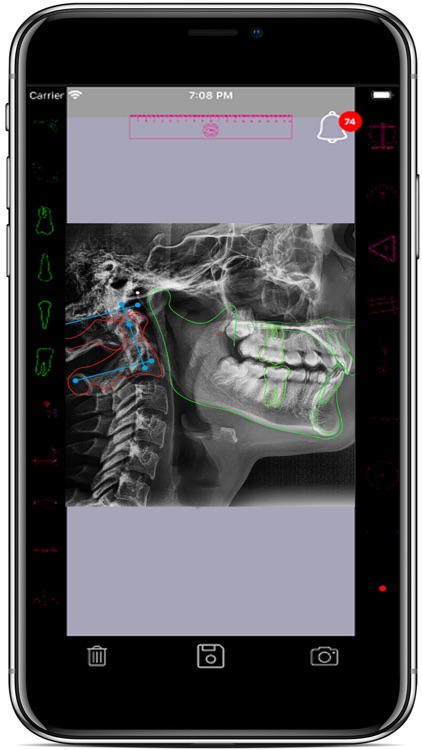 CRANIO-CERVICAL By OKT Apps screenshot-4