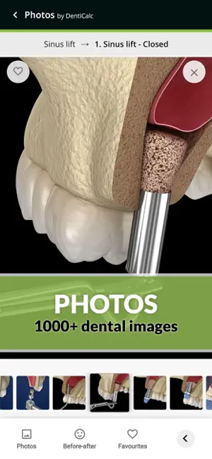 Captura de Pantalla 6 DentiCalc 4in1: Dental Care iphone