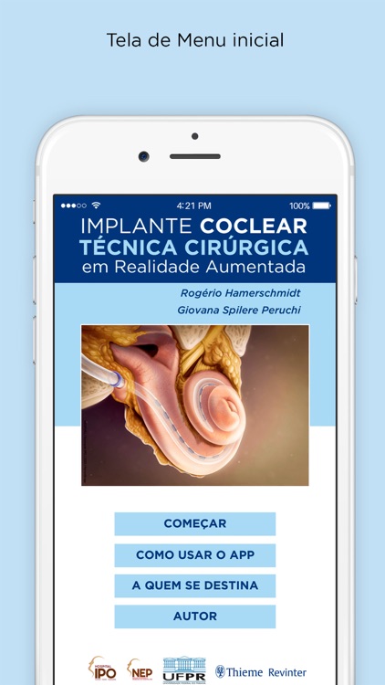 IPO Implante Coclear RA