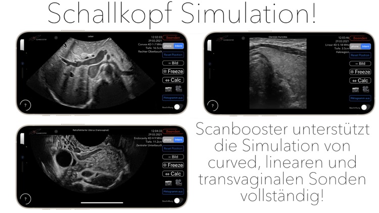 Scanbooster Ultraschall - Sono screenshot-6