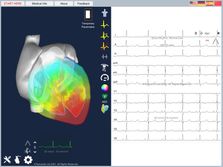 Epicardio Heart Simulator screenshot-3