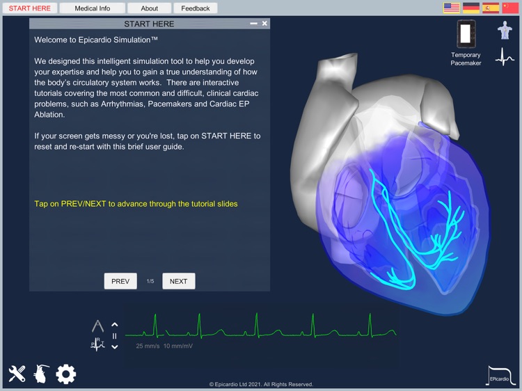 Epicardio Heart Simulator screenshot-4