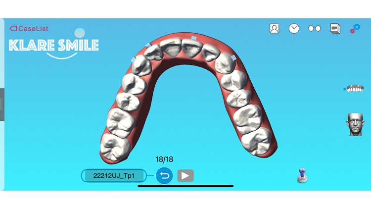 Klare smile screenshot-3