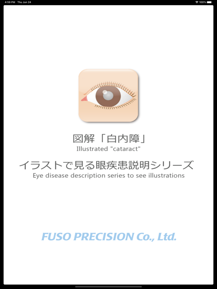 図解「白内障」イラストで見る眼疾患説明シリーズ