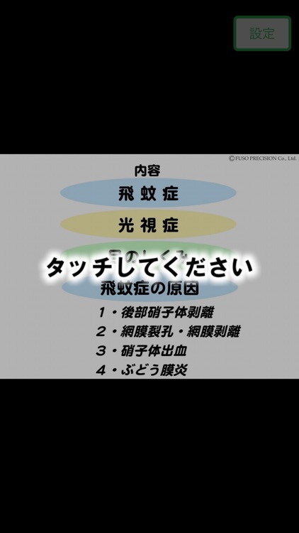 図解「飛蚊症」イラストで見る眼疾患説明シリーズ