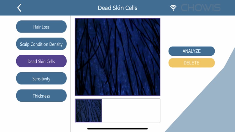 Chowis Hair Analyzer 2