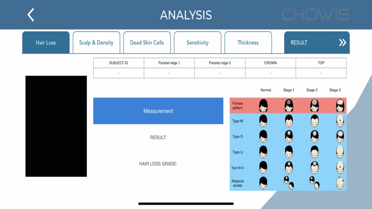 Chowis Hair Analyzer 2