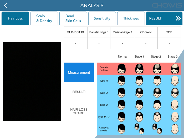 Chowis Hair Analyzer 2