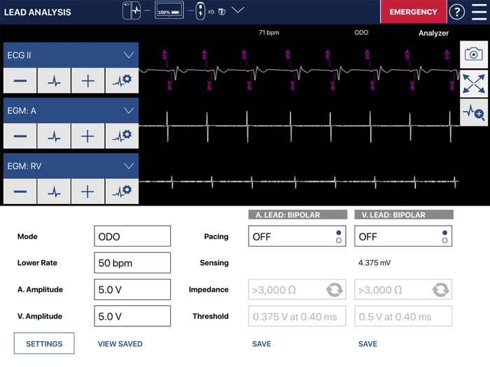 CareLink SmartSync™ RWL