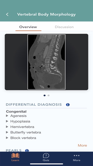 CTisus L-Spine Pathology screenshot 2