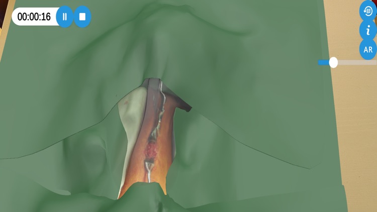 YourAnastomosis screenshot-6