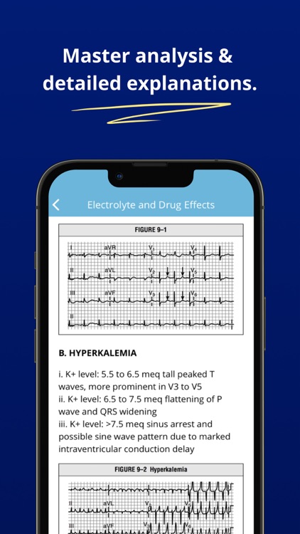 ECG EKG Interpretation Mastery screenshot-2